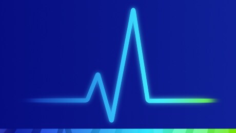 Pulse graphic
